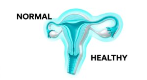 자궁의 건강한 구조를 보여주는 의학적 다이어그램